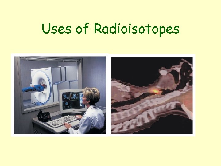 Uses of Radioisotopes 