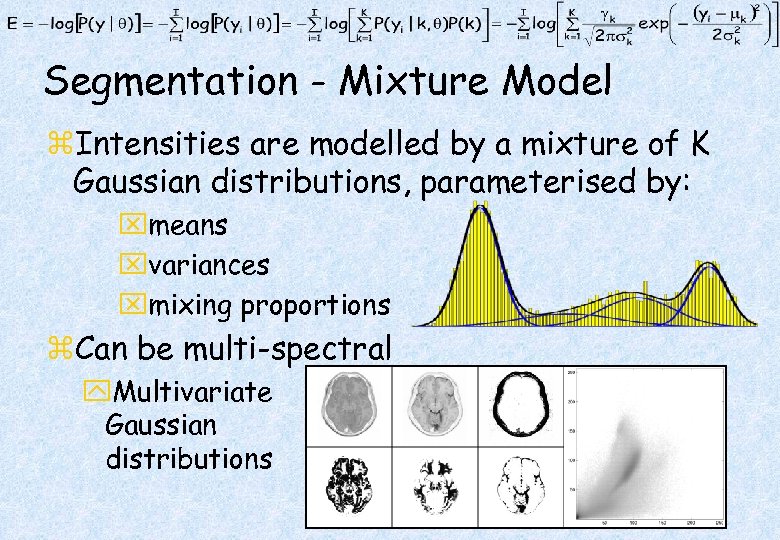 Segmentation - Mixture Model z. Intensities are modelled by a mixture of K Gaussian