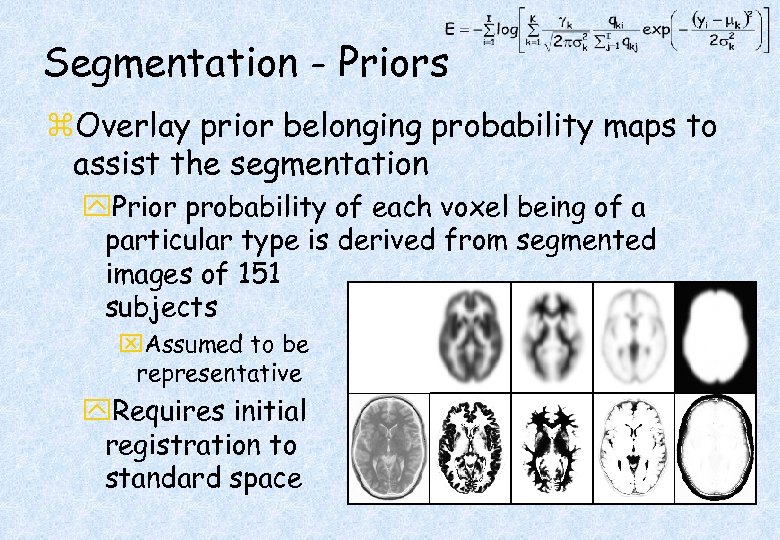 Segmentation - Priors z. Overlay prior belonging probability maps to assist the segmentation y.