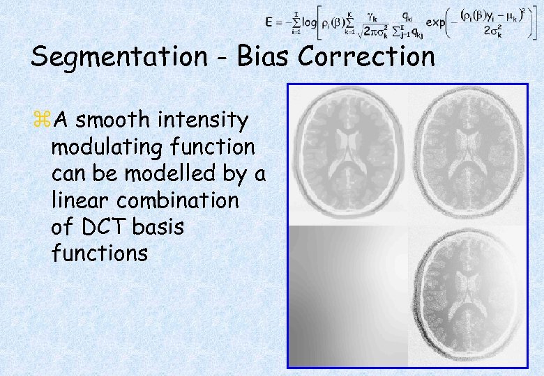 Segmentation - Bias Correction z. A smooth intensity modulating function can be modelled by