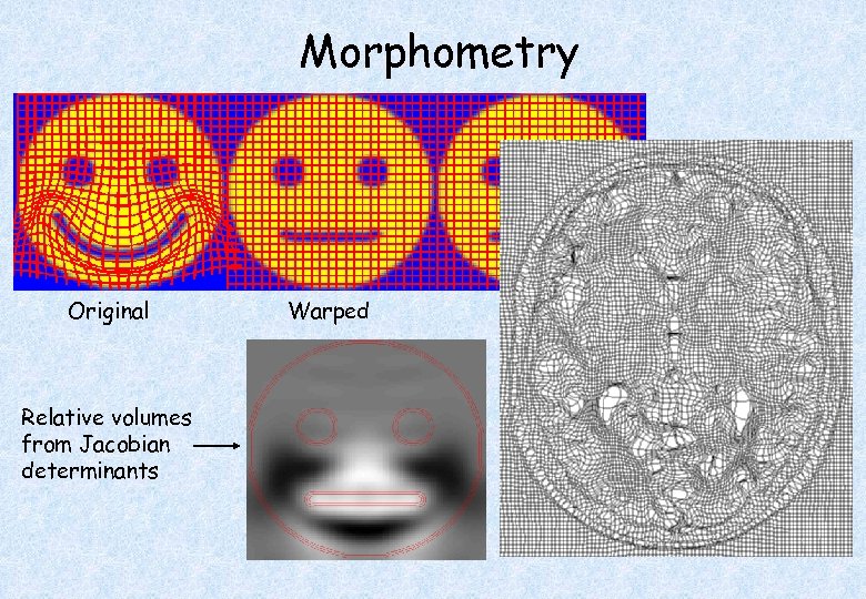 Morphometry Original Relative volumes from Jacobian determinants Warped Template 