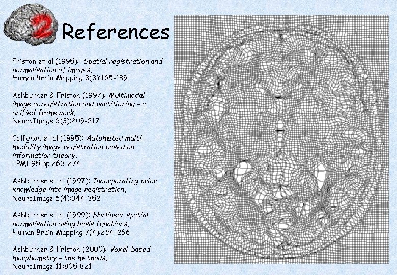 References Friston et al (1995): Spatial registration and normalisation of images. Human Brain Mapping