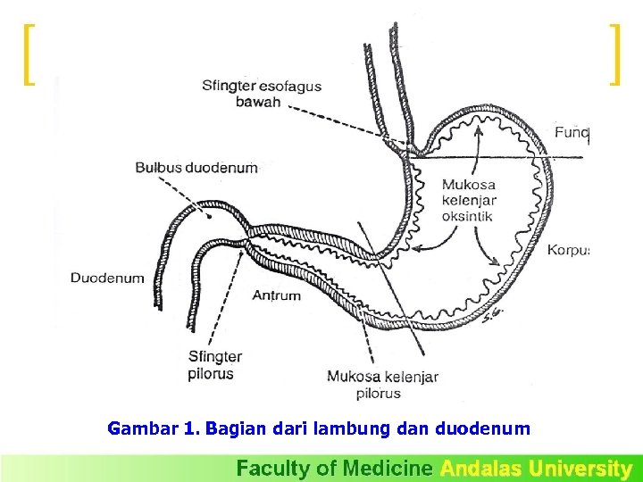 Gambar 1. Bagian dari lambung dan duodenum 
