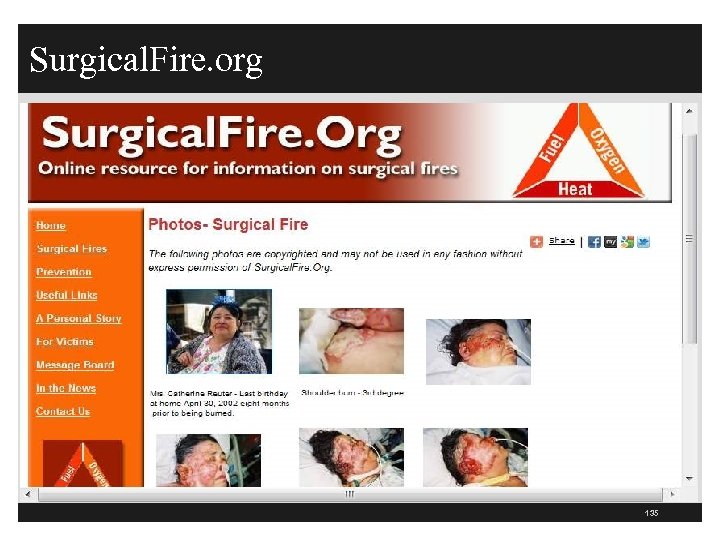 Surgical. Fire. org 135 