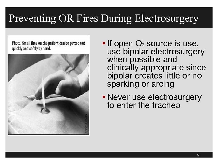 Preventing OR Fires During Electrosurgery § If open O 2 source is use, use