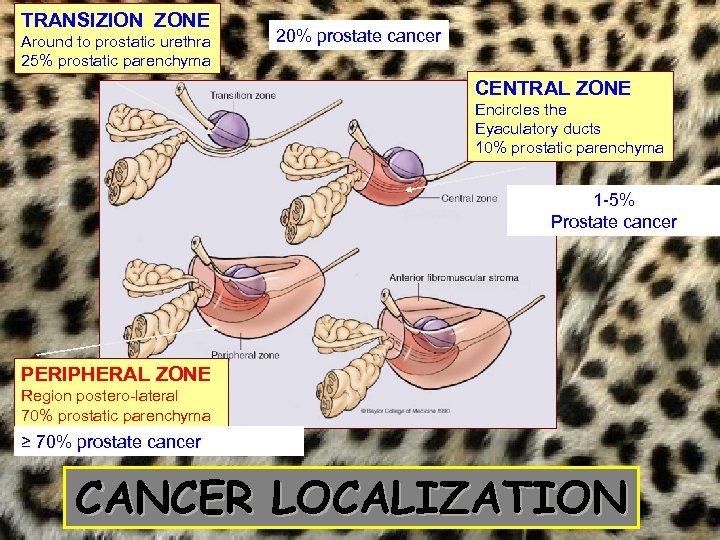 TRANSIZION ZONE Around to prostatic urethra 25% prostatic parenchyma 20% prostate cancer CENTRAL ZONE