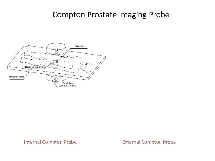 Compton Prostate Imaging Probe Internal Compton Probe External Compton Probe 