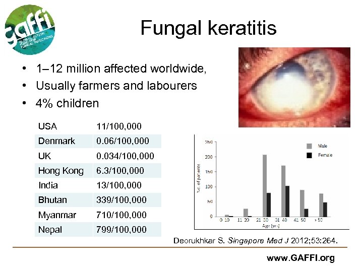 Fungal keratitis • 1– 12 million affected worldwide, • Usually farmers and labourers •