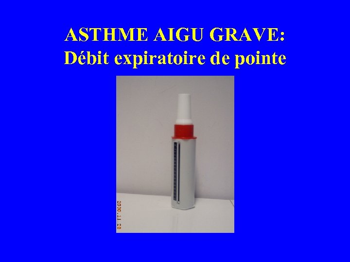 ASTHME AIGU GRAVE: Débit expiratoire de pointe 