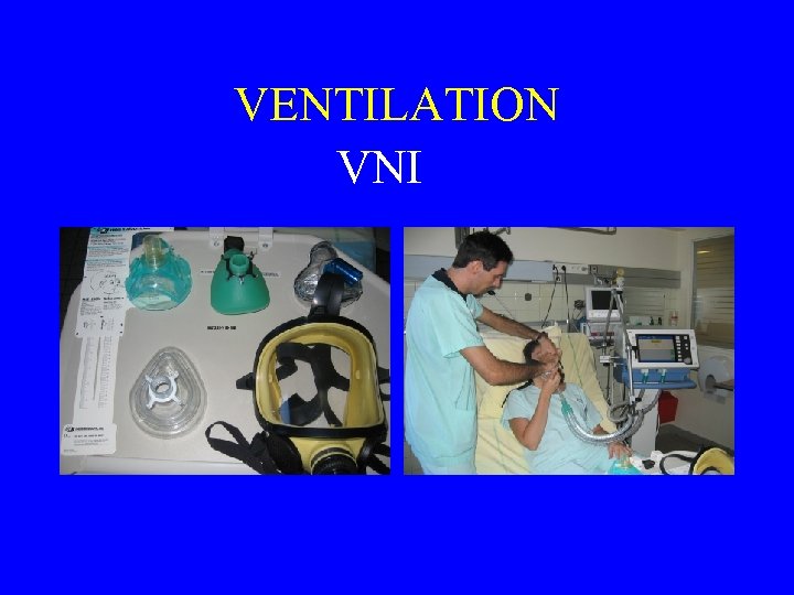 VENTILATION VNI 