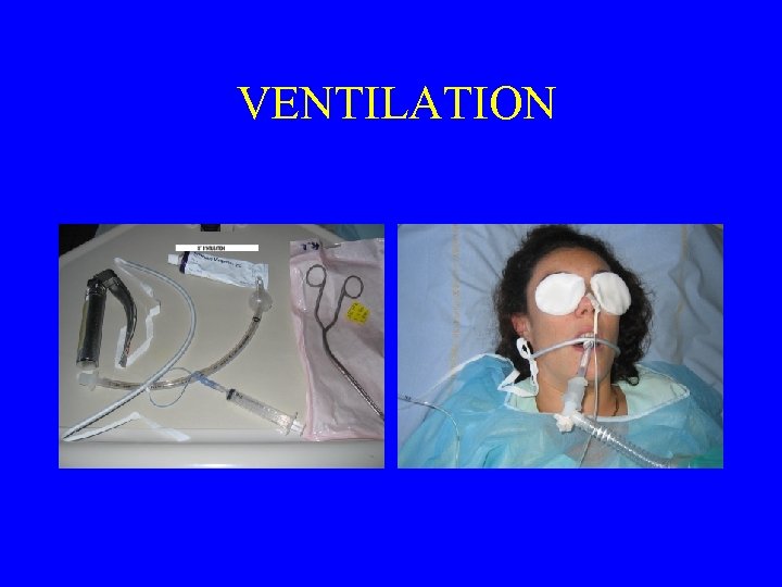  VENTILATION 