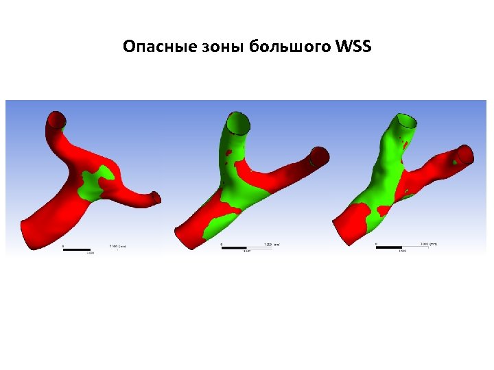 Опасные зоны большого WSS 