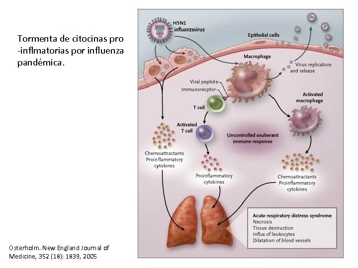 Tormenta de citocinas pro -inflmatorias por influenza pandémica. Osterholm. New England Journal of Medicine,