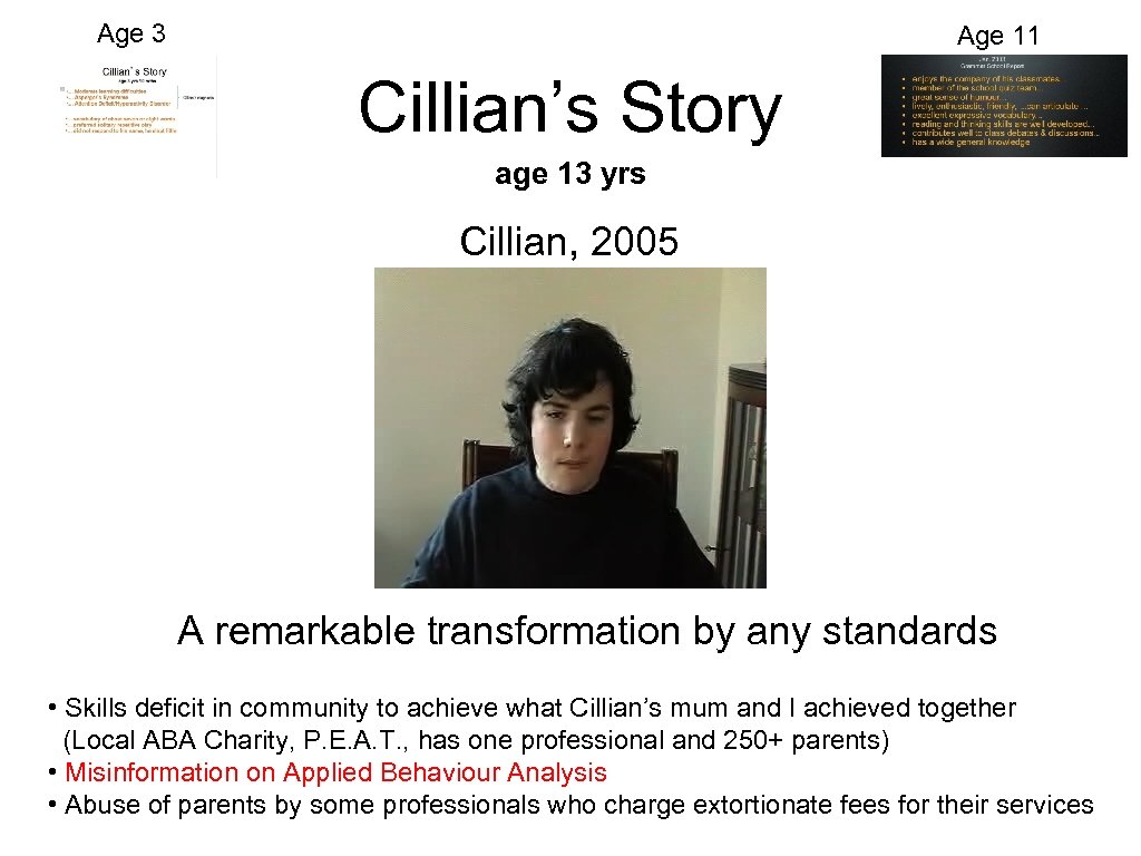 Age 3 Age 11 Cillian’s Story age 13 yrs Cillian, 2005 A remarkable transformation