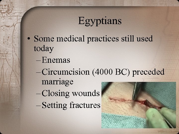 Egyptians • Some medical practices still used today – Enemas – Circumcision (4000 BC)