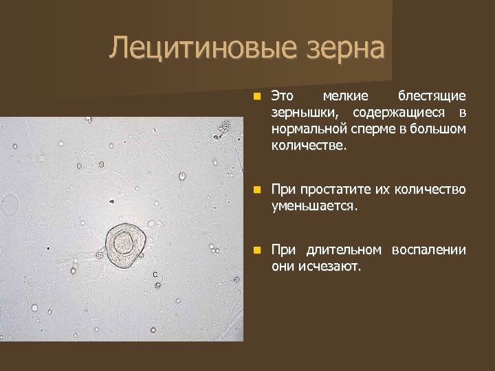 Лецитиновые зерна Это мелкие блестящие зернышки, содержащиеся в нормальной сперме в большом количестве. При