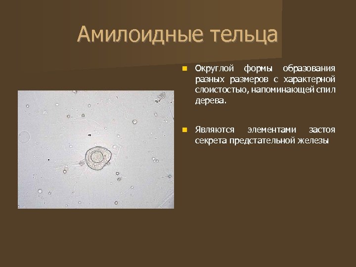 Амилоидные тельца Округлой формы образования разных размеров с характерной слоистостью, напоминающей спил дерева. Являются