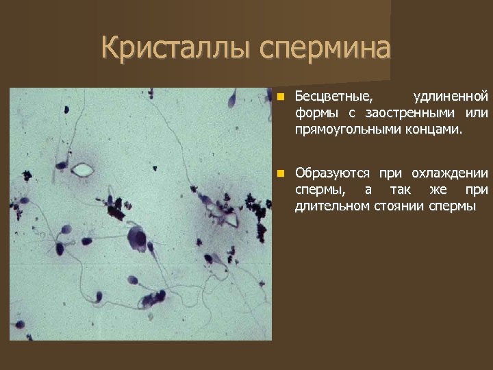 Кристаллы спермина Бесцветные, удлиненной формы с заостренными или прямоугольными концами. Образуются при охлаждении спермы,