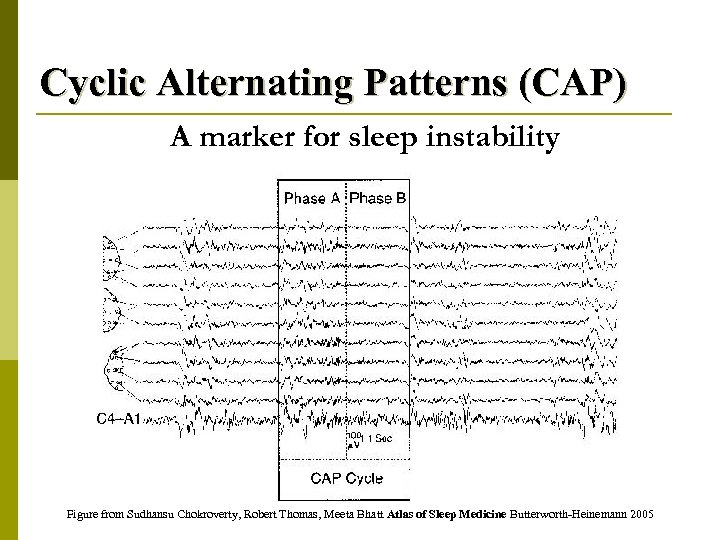 Cyclic Alternating Patterns (CAP) A marker for sleep instability Figure from Sudhansu Chokroverty, Robert
