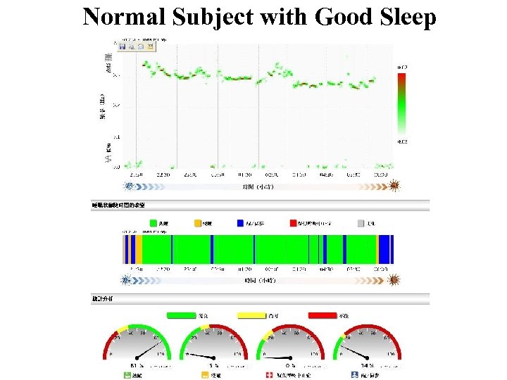 Normal Subject with Good Sleep 