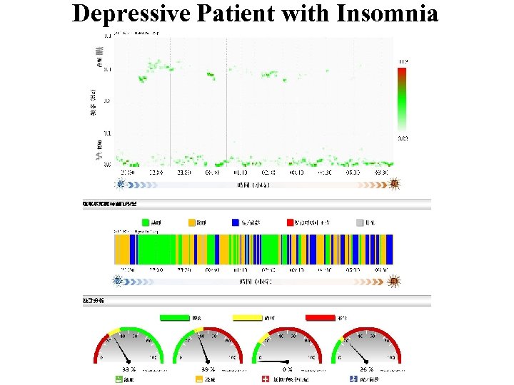 Depressive Patient with Insomnia 