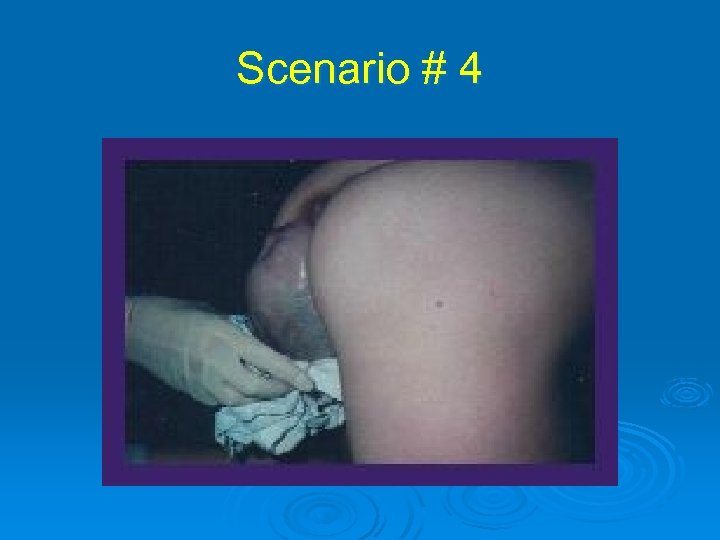 Scenario # 4 