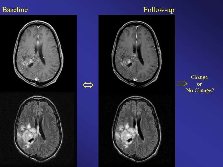 Baseline Follow-up Change or No Change? 