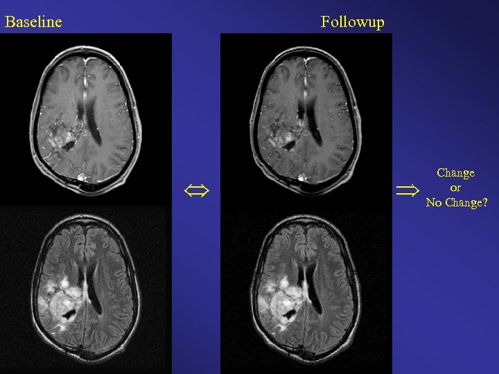 Baseline Followup Change or No Change? 