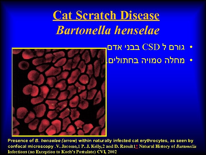 Cat Scratch Disease Bartonella Henselae בבני אדם CSD