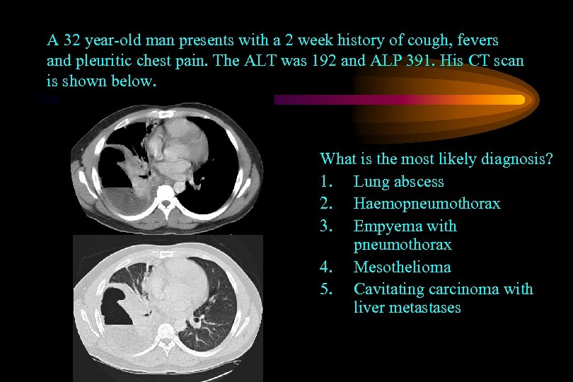 A 32 year-old man presents with a 2 week history of cough, fevers and