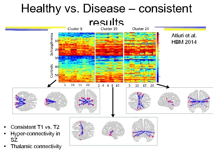 Healthy vs. Disease – consistent results Atluri et al. HBM 2014 • Consistent T