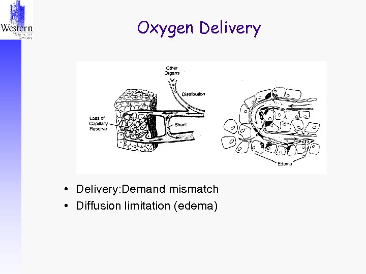 Oxygen Delivery • Delivery: Demand mismatch • Diffusion limitation (edema) 