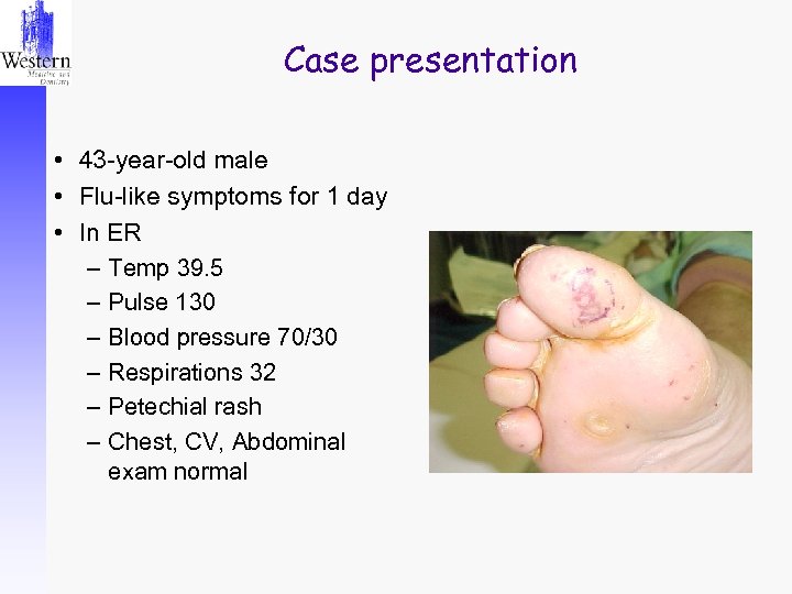 Case presentation • 43 -year-old male • Flu-like symptoms for 1 day • In