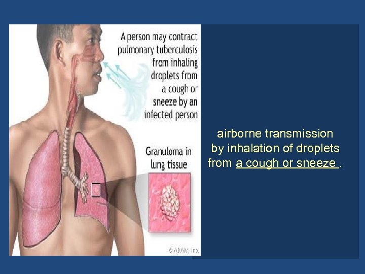 airborne transmission by inhalation of droplets from a cough or sneeze. 