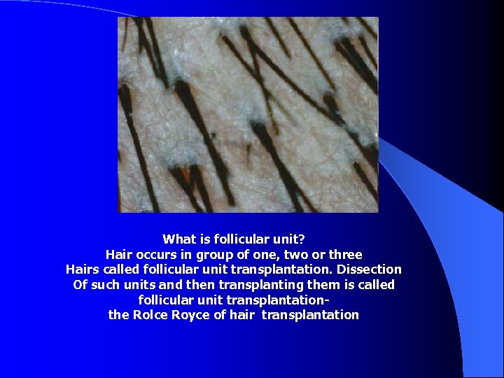 What is follicular unit? Hair occurs in group of one, two or three Hairs