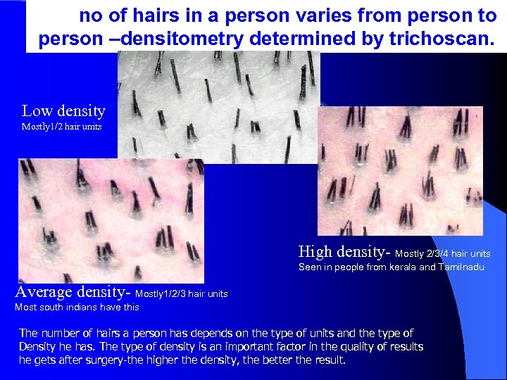 no of hairs in a person varies from person to person –densitometry determined by