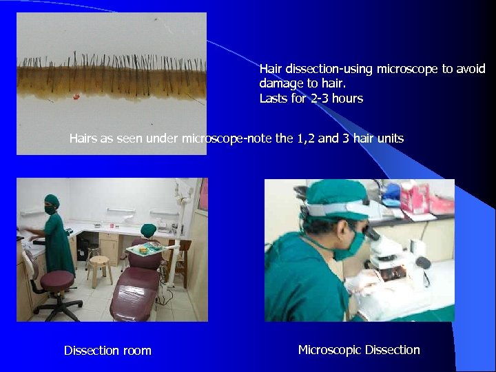 Hair dissection-using microscope to avoid damage to hair. Lasts for 2 -3 hours Hairs