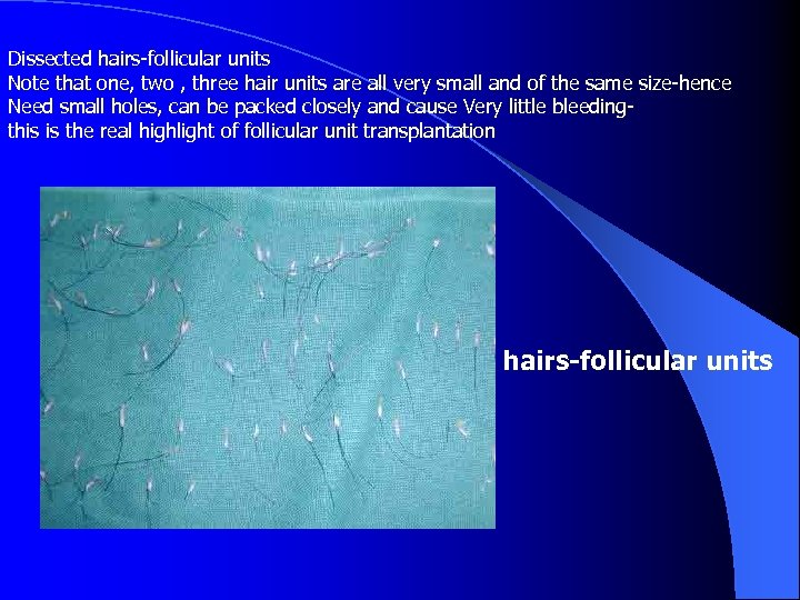 Dissected hairs-follicular units Note that one, two , three hair units are all very