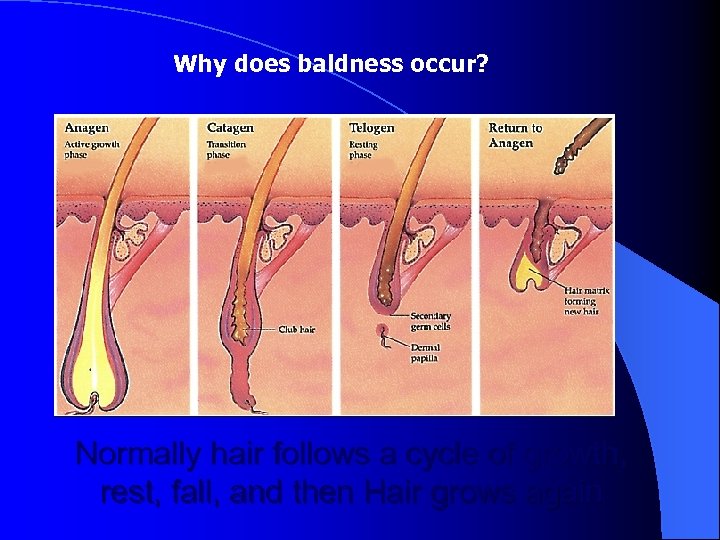 Why does baldness occur? Normally hair follows a cycle of growth, rest, fall, and