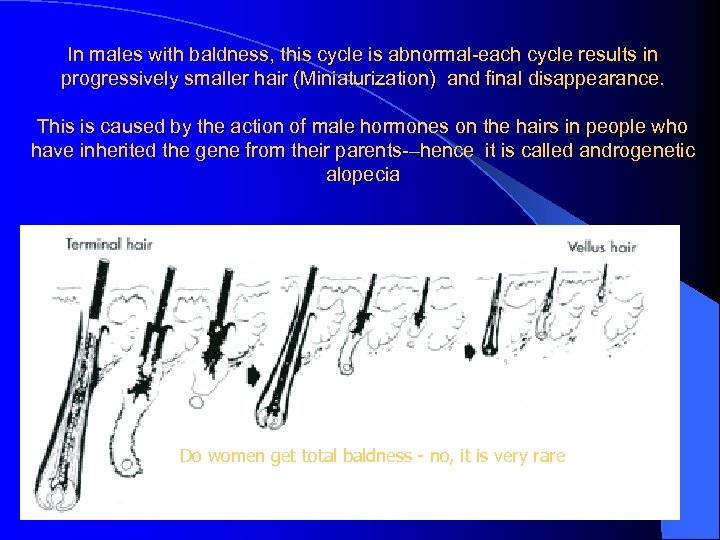 In males with baldness, this cycle is abnormal-each cycle results in progressively smaller hair