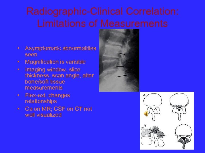 Radiographic-Clinical Correlation: Limitations of Measurements • Asymptomatic abnormalities seen • Magnification is variable •