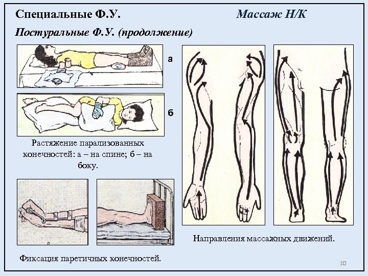 Специальные Ф. У. Массаж Н/К Постуральные Ф. У. (продолжение) а б Растяжение парализованных конечностей: