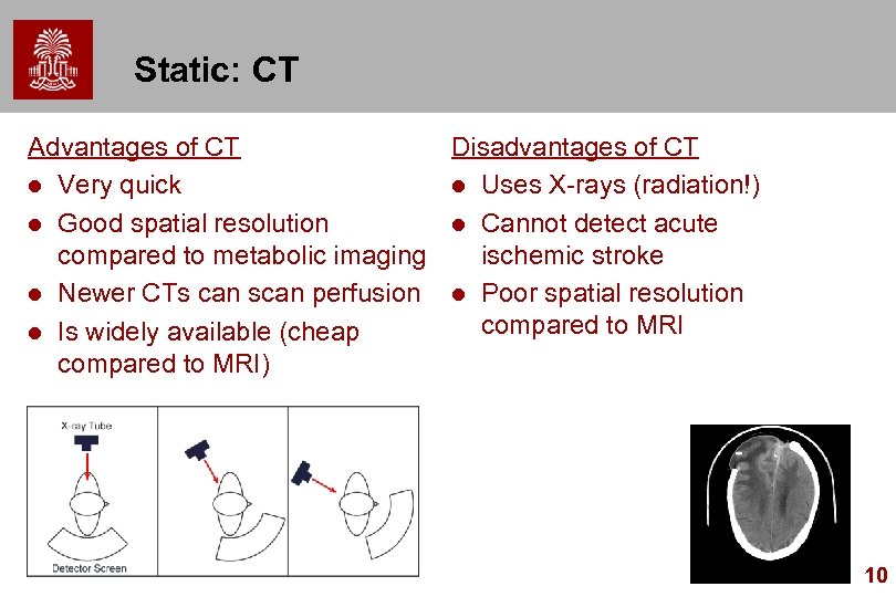 Static: CT Disadvantages of CT Advantages of CT l Uses X-rays (radiation!) l Very