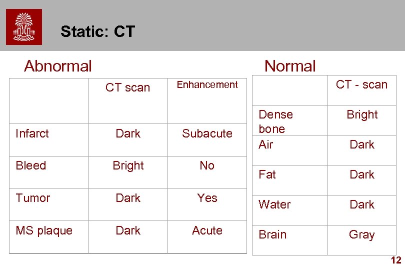 Static: CT Abnormal Normal CT scan Enhancement CT - scan Dense bone Air Bright