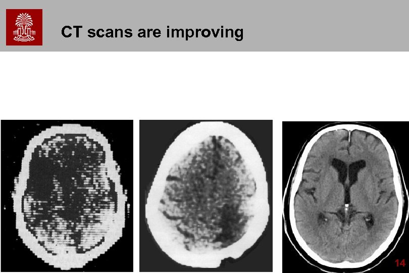 CT scans are improving 14 