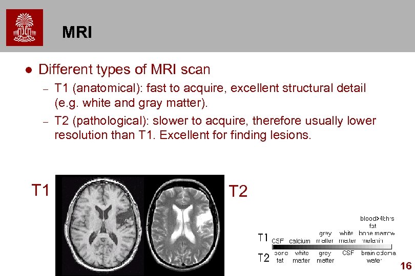 MRI l Different types of MRI scan – – T 1 (anatomical): fast to