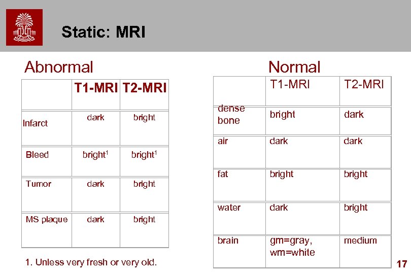 Static: MRI Abnormal Normal Tumor MS plaque bright 1 dark bright T 2 -MRI