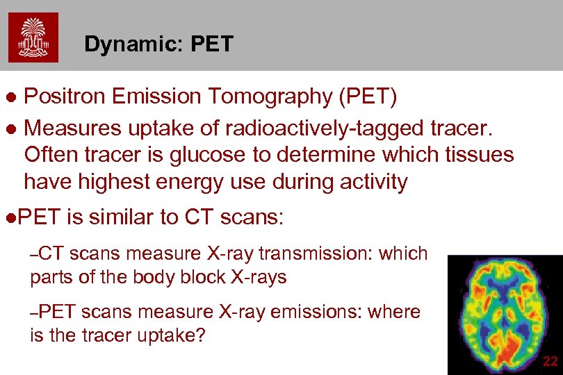 Dynamic: PET Positron Emission Tomography (PET) l Measures uptake of radioactively-tagged tracer. Often tracer