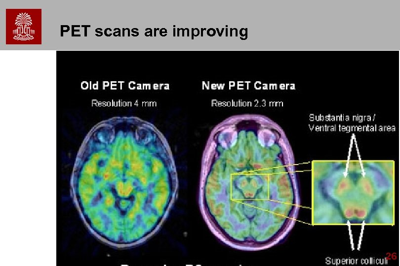 PET scans are improving 26 