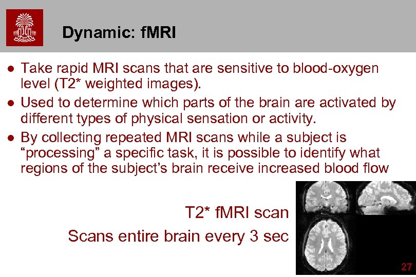 Dynamic: f. MRI l l l Take rapid MRI scans that are sensitive to